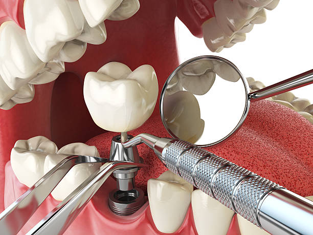 Best Emergency Dentist for Knocked-Out Tooth in Wayne Heights, PA